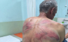 Prijavljeno brutalno prebijanje na Kosovu: Rašković tvrdi da su ga policajci vezali za drvo
